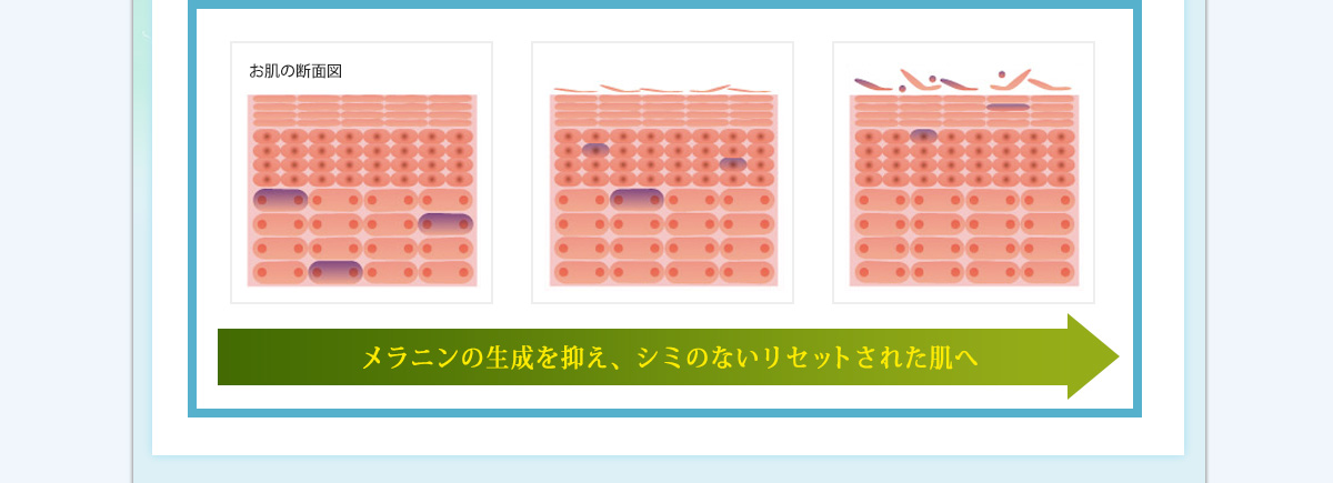 メラニンの生成を抑え、シミのないリセットされた肌へ